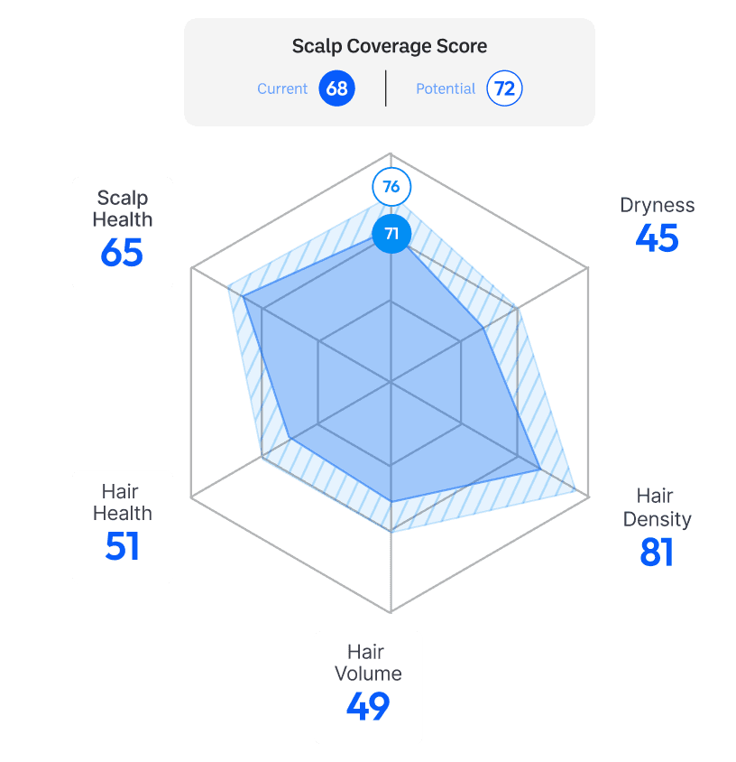 Chart 3