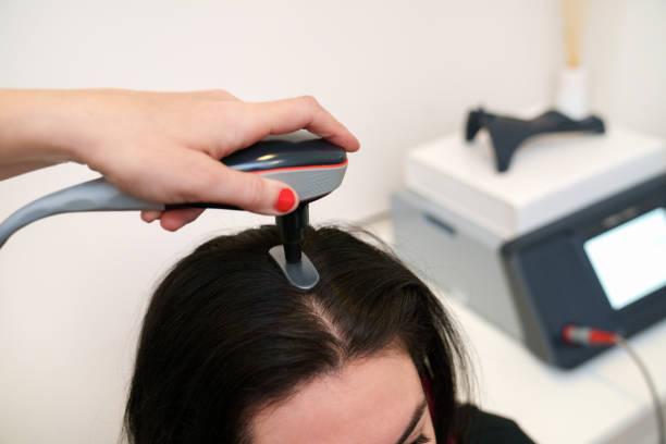 Exploring the Latest Hair Loss Treatment Innovations