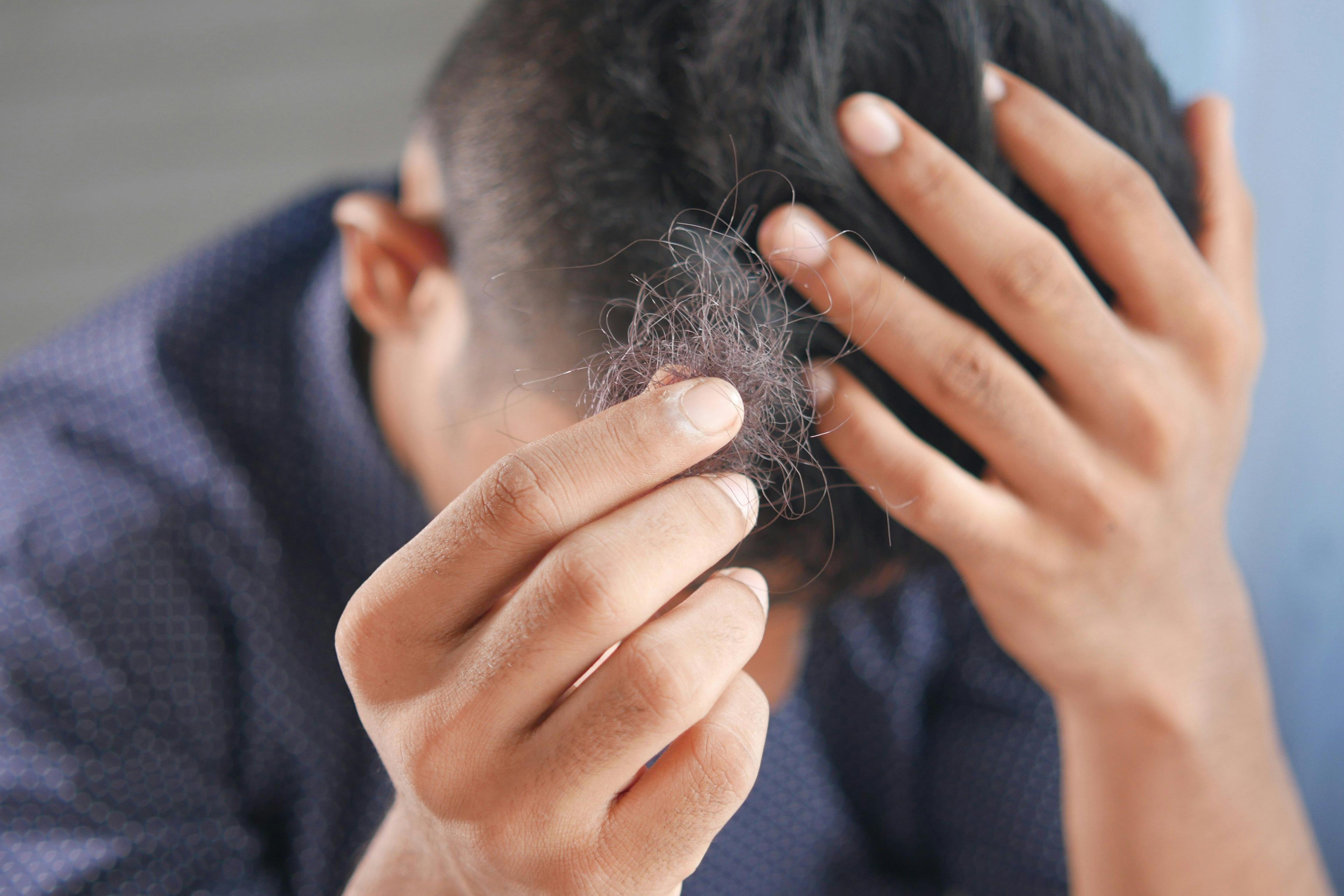 a man is holding his hair with his hands