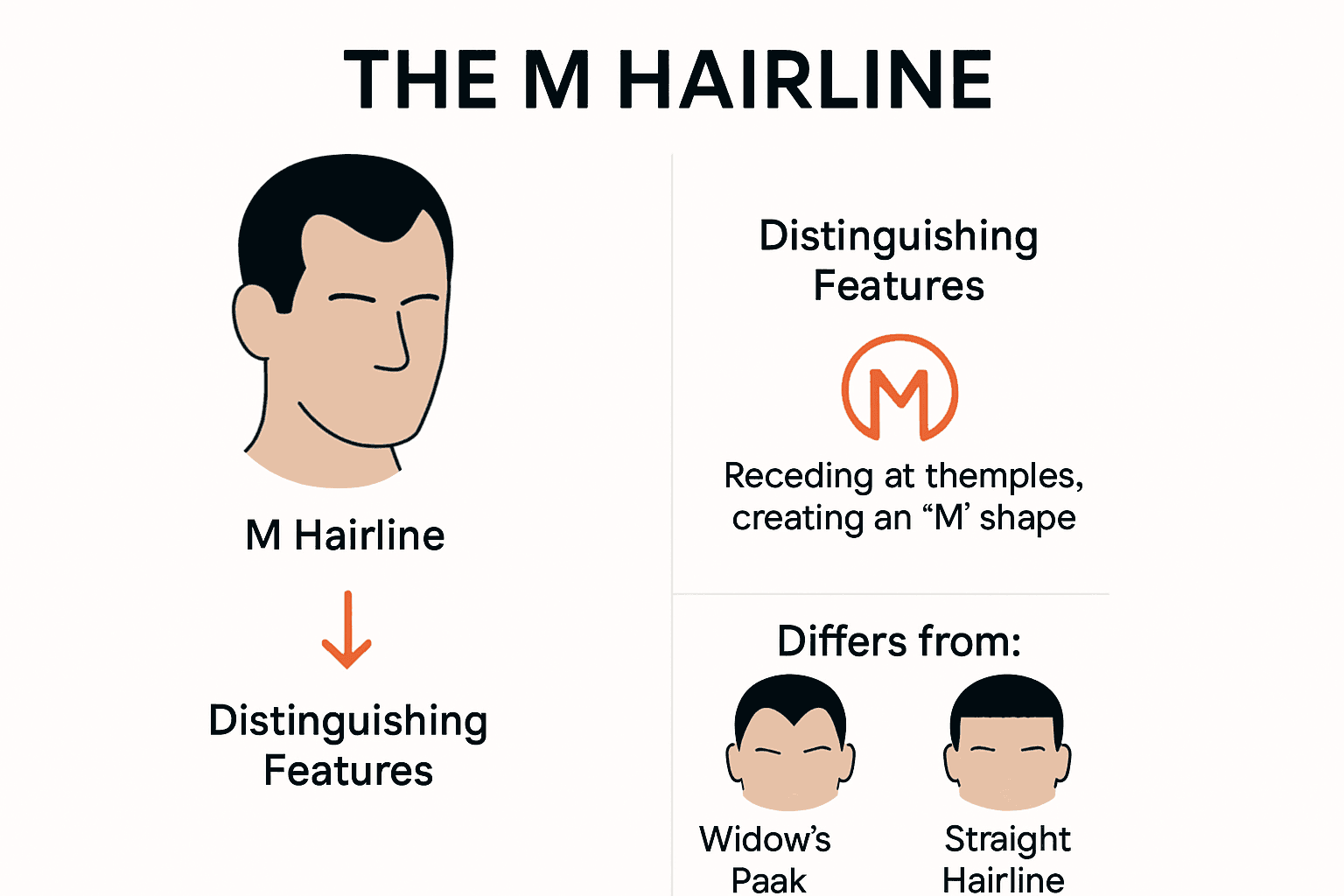 Illustration comparing M hairline with other hairline types
