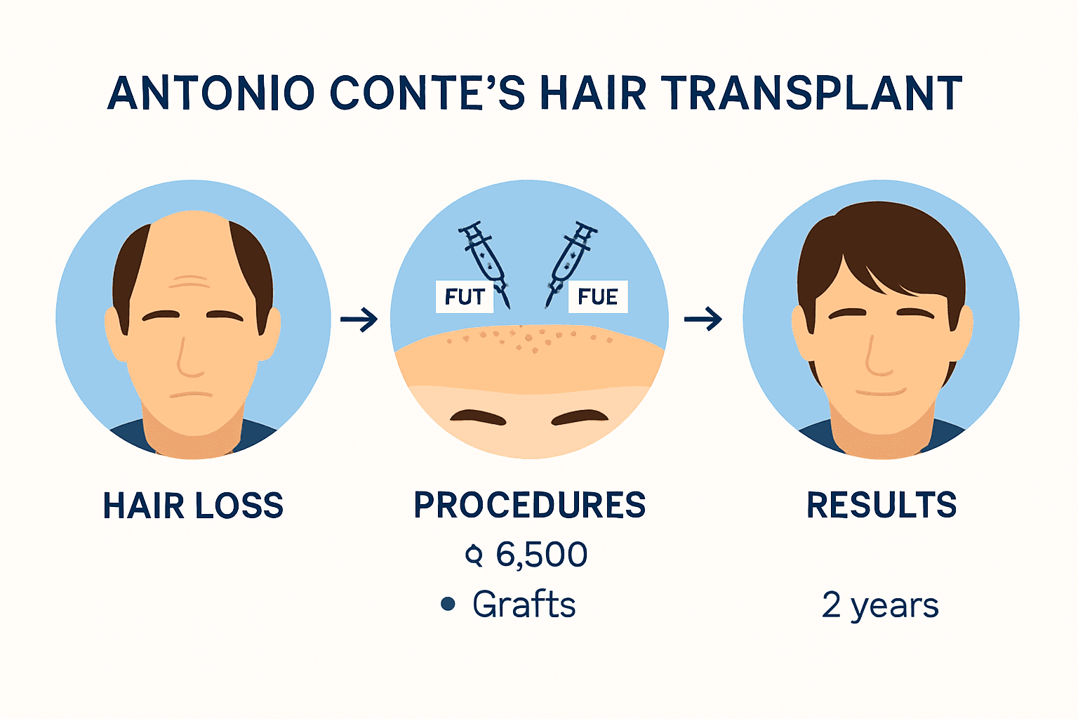 Conte hair transplant journey timeline and stages infographic
