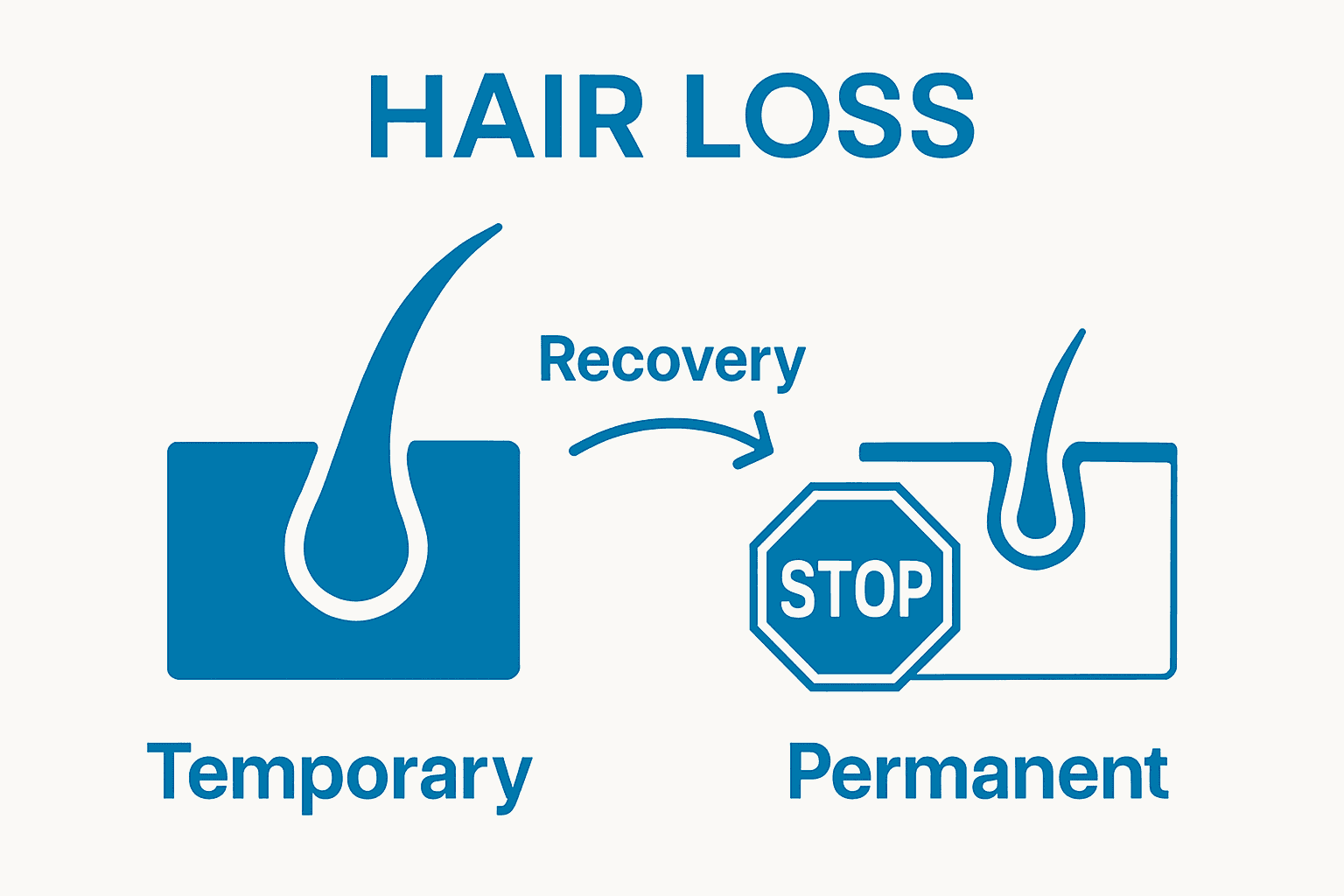 Infographic comparing temporary and permanent hair thinning in men
