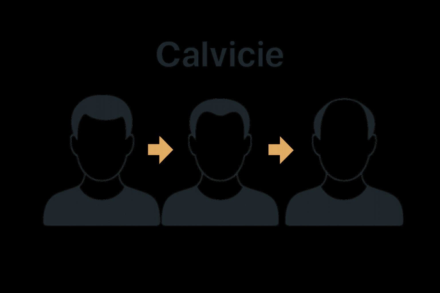 Infografía etapas calvicie masculina visualmente