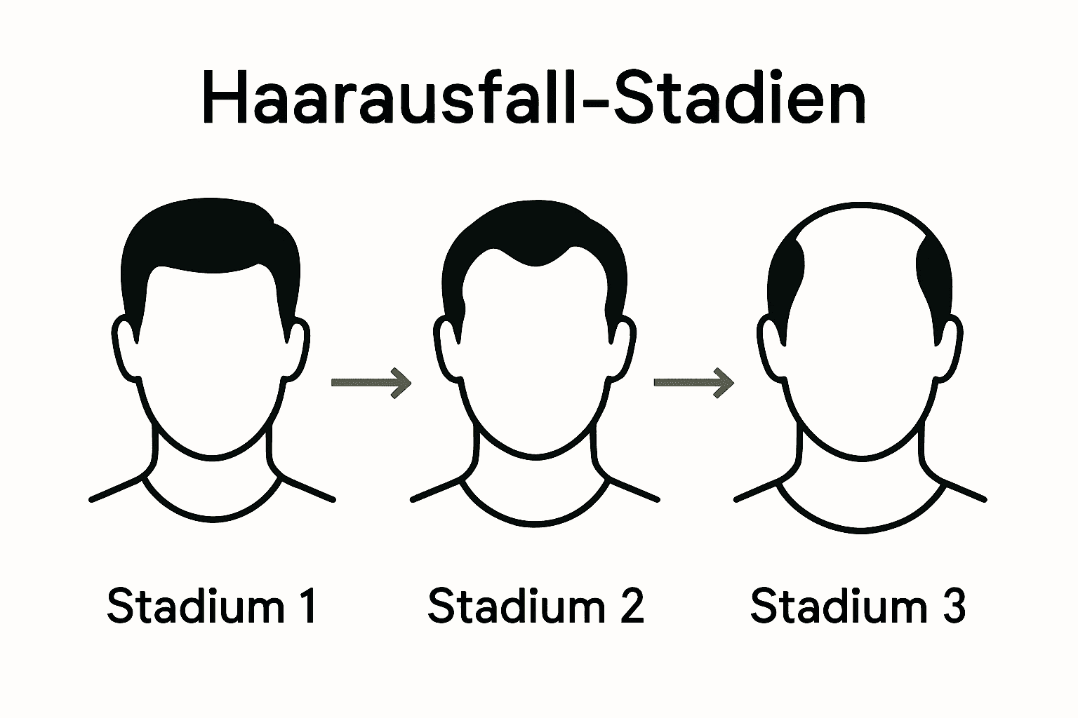 Drei Männerköpfe mit unterschiedlichem Haarausfallmuster