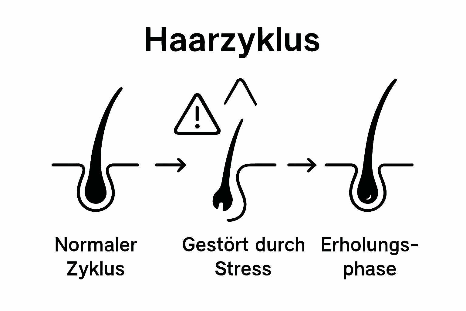 Grafik: Vergleich des normalen Haarzyklus mit dem Haarzyklus unter Stress